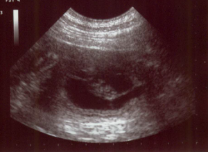 Eleanors Ultrasound